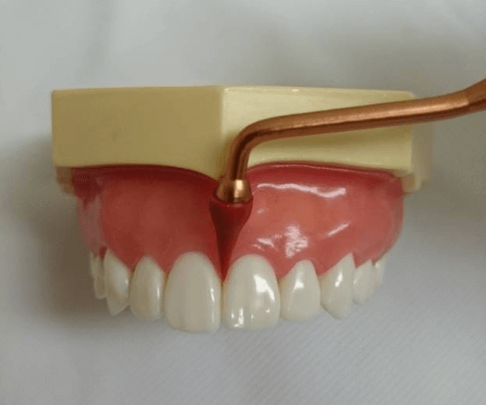 歯肉の形態を考え