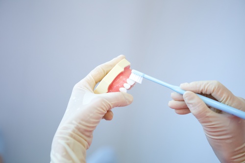 歯周病の専門家から見たときの予防歯科とは？